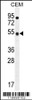 Western blot analysis in CEM cell line lysates (35ug/lane) .