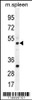 Western blot analysis in mouse spleen tissue lysates (35ug/lane) .