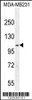 Western blot analysis in MDA-MB231 cell line lysates (35ug/lane) .