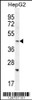 Western blot analysis in HepG2 cell line lysates (35ug/lane) .