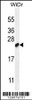 Western blot analysis in WiDr cell line lysates (35ug/lane) .