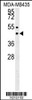 Western blot analysis in MDA-MB435 cell line lysates (35ug/lane) . This demonstrates the SUV39H1 antibody detected the SUV39H1 protein (arrow) .