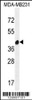 Western blot analysis in MDA-MB231 cell line lysates (35ug/lane) .