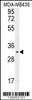 Western blot analysis in MDA-MB435 cell line lysates (35ug/lane) .