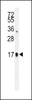 Western blot analysis in HepG2 cell line lysates (35ug/lane) .