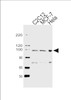 Western blot analysis of lysates from C2C12, MCF-7, Hela cell line (from left to right) , using HSP90B1 Antibody at 1:1000 at each lane.