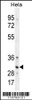 Western blot analysis in Hela cell line lysates (35ug/lane) .