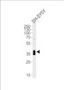 Western blot analysis of lysate from SH‑SY5Y cell line, using MSI1 Antibody at 1:1000 at each lane.