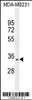 Western blot analysis in MDA-MB231 cell line lysates (35ug/lane) .