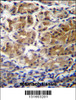 PDPR Antibdy immunohistochemistry analysis in formalin fixed and paraffin embedded human stomach tissue followed by peroxidase conjugation of the secondary antibody and DAB staining.This data demonstrates the use of PDPR Antibdy for immunohistochemistry.