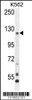 Western blot analysis in K562 cell line lysates (35ug/lane) .