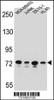 Western blot analysis in MDA-MB453, Jurkat, ZR-75-1, HL-60 cell line lysates (35ug/lane) .