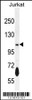 Western blot analysis in Jurkat cell line lysates (35ug/lane) .