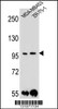 Western blot analysis in MDA-MB453, ZR-75-1 cell line lysates (35ug/lane) .