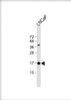 Western Blot at 1:1000 dilution + LNCaP whole cell lysate Lysates/proteins at 20 ug per lane.