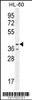 Western blot analysis in HL-60 cell line lysates (35ug/lane) .