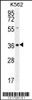 Western blot analysis in K562 cell line lysates (35ug/lane) .