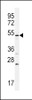 Western blot analysis in U251 cell line lysates (35ug/lane) .