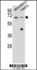 Western blot analysis in MDA-MB231, HepG2 cell line lysates (35ug/lane) .