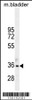 Western blot analysis in mouse bladder tissue lysates (35ug/lane) .This demonstrates the TGIF1 antibody detected the TGIF1 protein (arrow) .