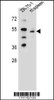 Western blot analysis in ZR-75-1 cell line and mouse spleen tissue lysates (35ug/lane) .