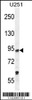 Western blot analysis in U251 cell line lysates (35ug/lane) .