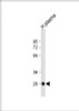 Western Blot at 1:2000 dilution + human plasma lysate Lysates/proteins at 20 ug per lane.