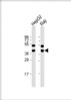 Western Blot at 1:1000 dilution Lane 1: HepG2 whole cell lysate Lane 2: Raji whole cell lysate Lysates/proteins at 20 ug per lane.