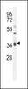 Western blot analysis in MDA-MB231 cell line lysates (35ug/lane) .