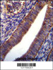 COL21A1 Antibody immunohistochemistry analysis in formalin fixed and paraffin embedded human uterus tissue followed by peroxidase conjugation of the secondary antibody and DAB staining.