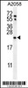 Western blot analysis in A2058 cell line lysates (35ug/lane) .