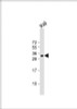 Western Blot at 1:1000 dilution + Raji whole cell lysate Lysates/proteins at 20 ug per lane.