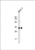 Western Blot at 1:1000 dilution + MCF-7 whole cell lysate Lysates/proteins at 20 ug per lane.