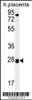 Western blot analysis in human placenta tissue lysates (35ug/lane) .