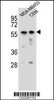 Western blot analysis in MDA-MB453, CEM cell line lysates (35ug/lane) .