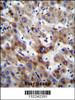 SLC25A6 Antibody immunohistochemistry analysis in formalin fixed and paraffin embedded human liver tissue followed by peroxidase conjugation of the secondary antibody and DAB staining.