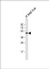 Western Blot at 1:1000 dilution + human fetal liver lysate Lysates/proteins at 20 ug per lane.