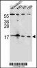 Western blot analysis in MDA-MB231, K562, 293, CEM cell line lysates (35ug/lane) .