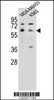 Western blot analysis in MDA-MB453, K562 cell line lysates (35ug/lane) .