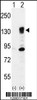 Western blot analysis of ITGA5 using rabbit polyclonal ITGA5 Antibody using 293 cell lysates (2 ug/lane) either nontransfected (Lane 1) or transiently transfected (Lane 2) with the ITGA5 gene.