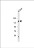 Western Blot at 1:1000 dilution + human liver lysate Lysates/proteins at 20 ug per lane.