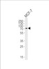 Western blot analysis of lysate from MCF-7 cell line, using KLC2 Antibody at 1:1000 at each lane.