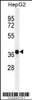 Western blot analysis in HepG2 cell line lysates (35ug/lane) .