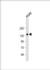 Western Blot at 1:1000 dilution + A549 whole cell lysate Lysates/proteins at 20 ug per lane.