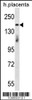 Western blot analysis in human placenta tissue lysates (35ug/lane) .