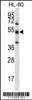 Western blot analysis in HL-60 cell line lysates (35ug/lane) .