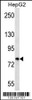 Western blot analysis in HepG2 cell line lysates (35ug/lane) .