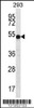 Western blot analysis in 293 cell line lysates (35ug/lane) .