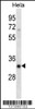 Western blot analysis in Hela cell line lysates (35ug/lane) .