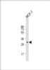 Western Blot at 1:1000 dilution + MCF-7 whole cell lysate Lysates/proteins at 20 ug per lane.